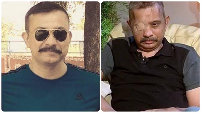 Chetan Kumar Cheetah, the braveheart who scripted a miraculous recovery after sustaining several bullet injuries is critical with COVID-19
