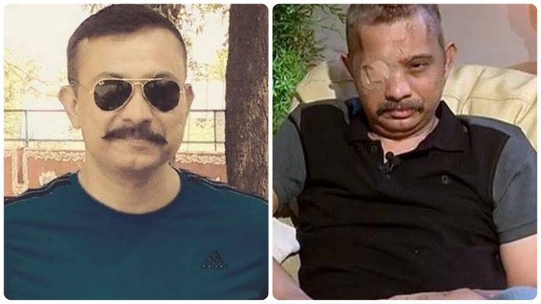Chetan Kumar Cheetah: CRPF braveheart who took 9 bullets and survived is now critical due to Covid