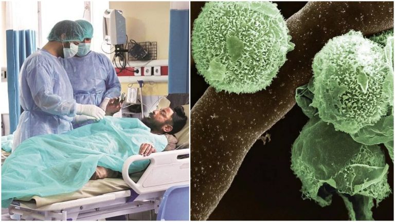 What is green fungus, and what are its early symptoms? How to prevent infection: All you need to know