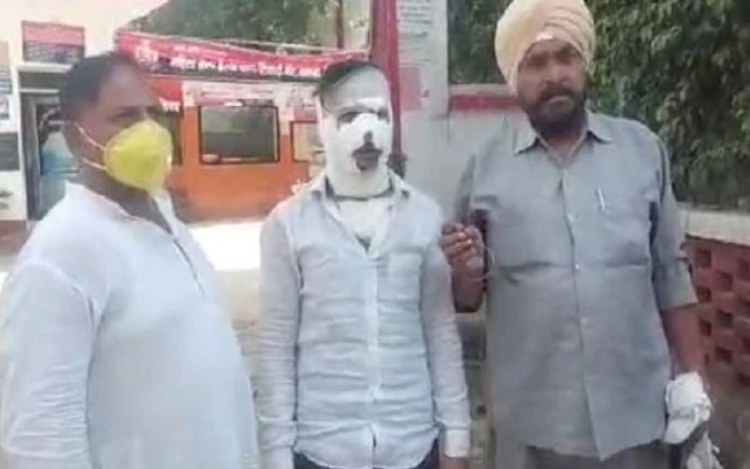 Halwai Tehseem’s son throws hot oil on minor Naushad’s face during fight over masks at Kachori shop, case registered