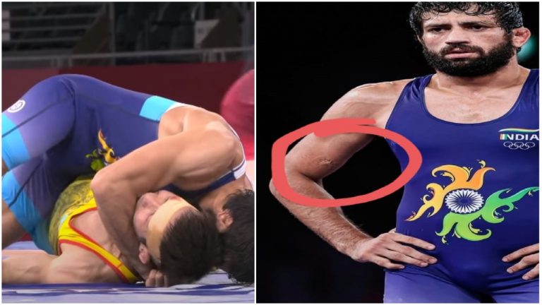 Watch: Indian wrestler Ravi Kumar Dahiya gets bitten by Kazakhstan athlete while competing to reach finals of Tokyo Olympics