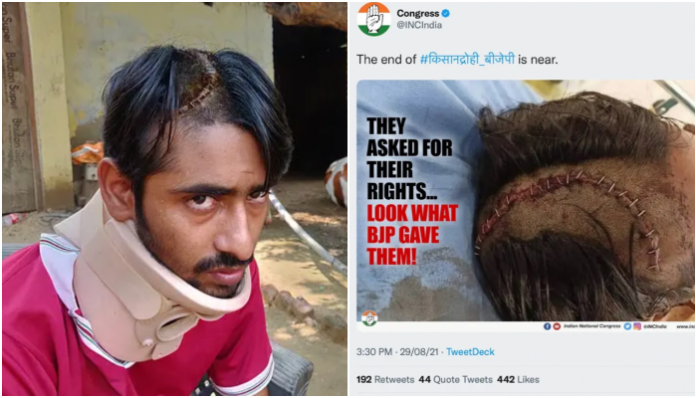 Congress misused the photo of a grievously injured Gau Rakshak and claimed he was a 'farmer protestor'