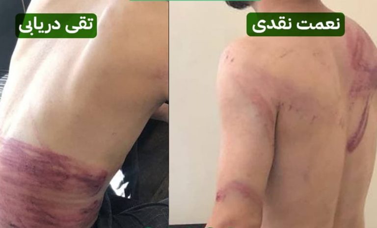 Afghanistan: Taliban flogs, assaults two journalists who were covering women’s protests