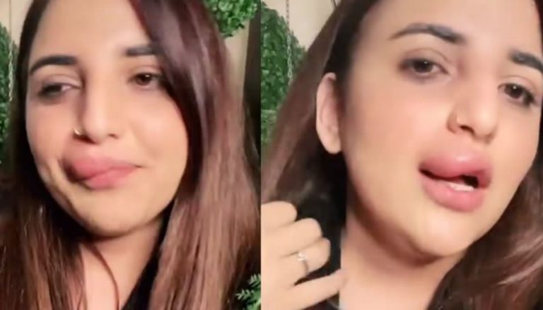 Pakistani TikToker Hareem Shah releases video with botched up lip job: How, because of FIA, she had to leave procedure midway