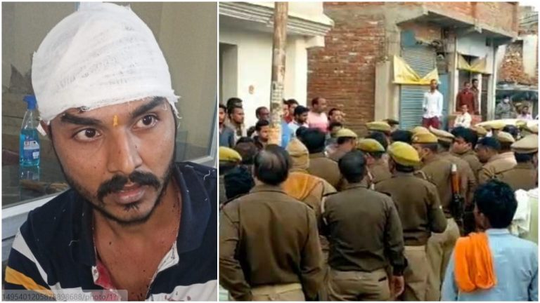 Uttar Pradesh: Muslim mob brutally attacks RSS worker with iron rods for discussing Karnataka burqa row, case registered