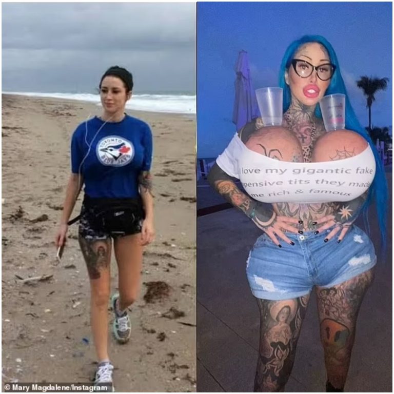 mary magdalene plastic surgery addict before Image 5