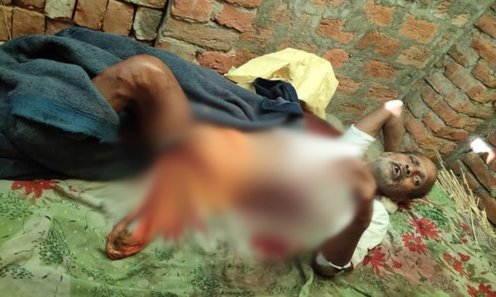 Bihar: 70-year-old paralysed priest shot by unknown miscreants at a Hanuman temple in Buxar district