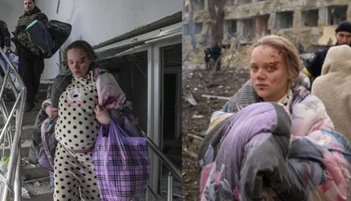 Russia attacks maternity hospital: How social media is divided over a picture?