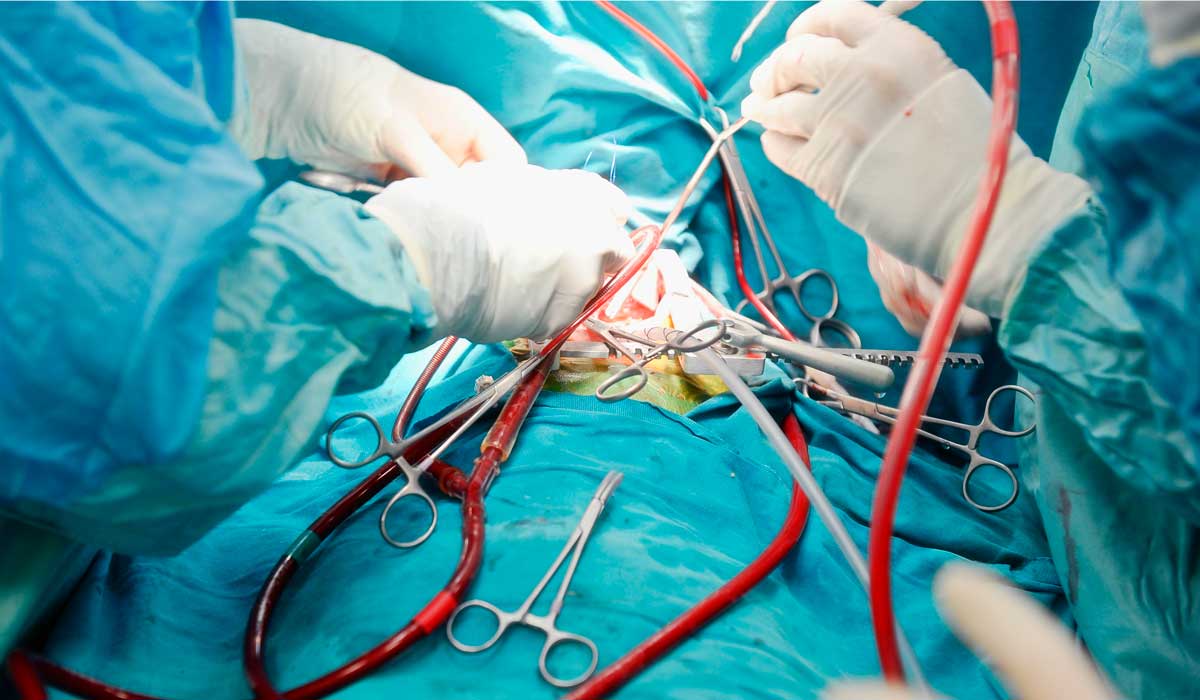 Chinese surgeons remove organs from living patients under state orders

 TOU
