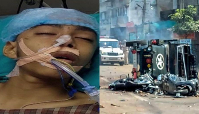Khargone violence: 16-year-old Shivam Shukla with severe head injuries is struggling for his life in the hospital
