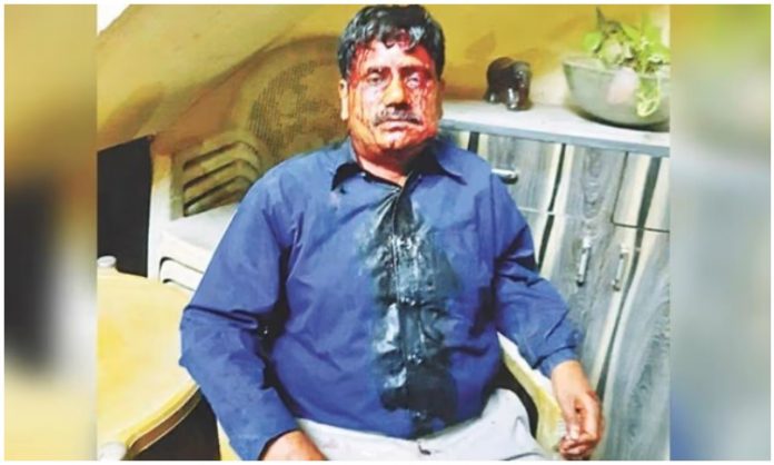 Amar Ujala journalist brutally attacked in Punjab