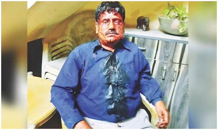 Punjab: Senior Amar Ujala journalist Alok Verma brutally attacked by unknown assailants, gets 27 stitches on head