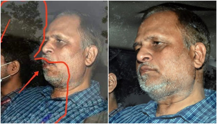 AAP leaders claim Satyendar Jain was beaten up in ED custody; pictures suggest otherwise
