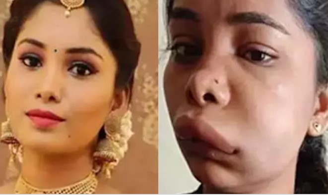 Kannada actress Swathi Sathish ends up with swollen face after a botched root canal; pictures go viral