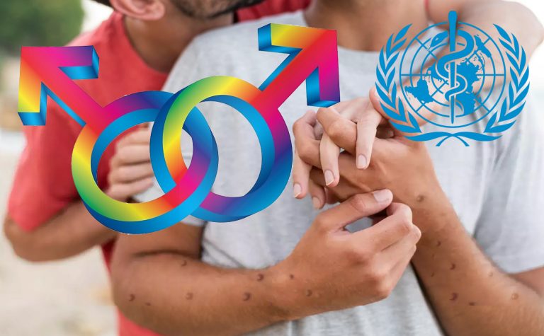 As most Monkeypox cases remain confined to gay men, WHO warns against stigmatisation, says it can spread to general population