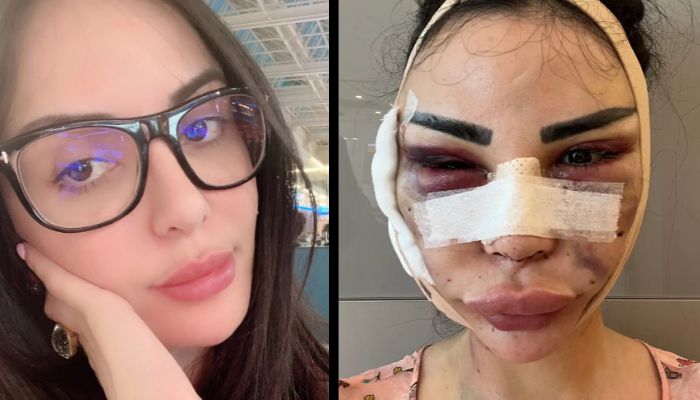 Model who spent $600K and 12 years to look like Kim Kardashian undergoes detransition after realising she wants to be herself