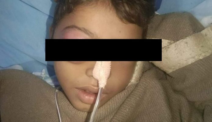 Rajasthan: 8-year-old Dalit kid dies after being assaulted by teacher