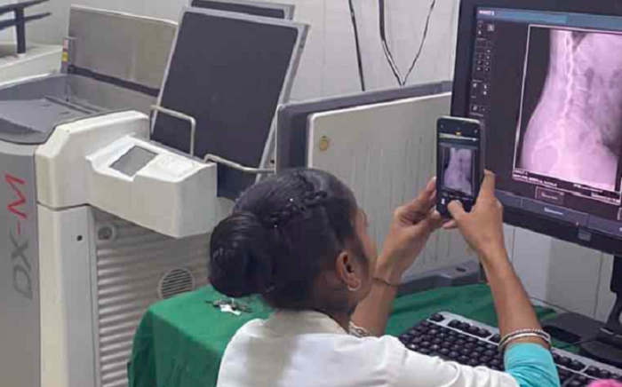 Punjab: Government hospital asks patients to click photos of X-ray on mobile phones citing shortage of physical films