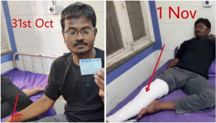 The truth about Morbi tragedy survivor's 'changing plaster' fake news spread by the usual suspects
