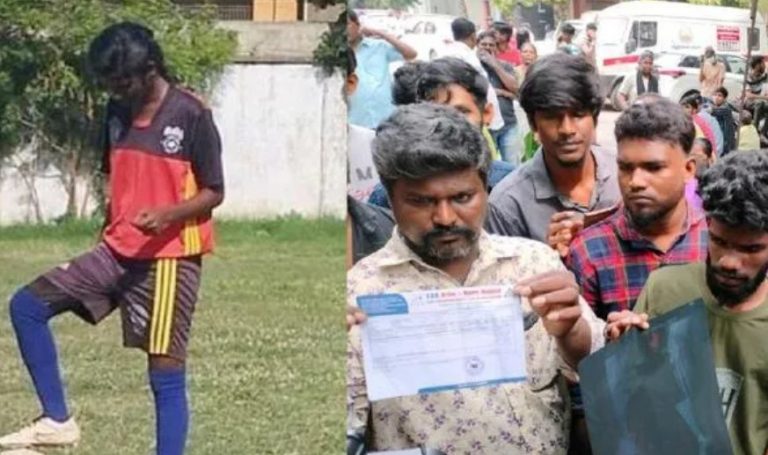 Chennai: 17-year-old budding footballer dies after losing a leg in botched surgery, two doctors suspended for negligence