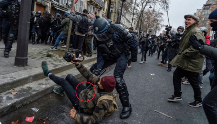 France: Engineer loses one of his testicles after being hit by a cop during protests