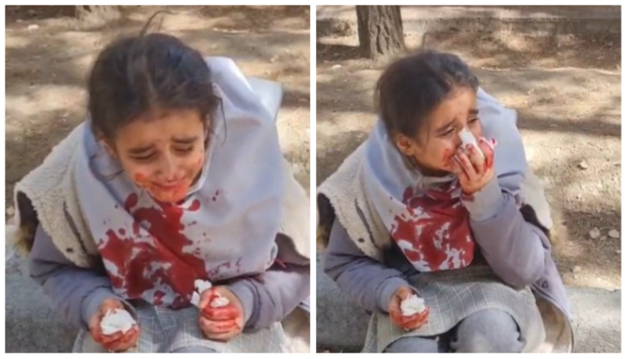 Iranian human rights activist shares news of vigilantes hitting a young girl on the face for not wearing hijab, fact-checkers claim news is misleading