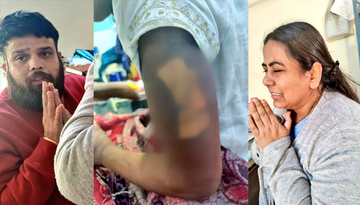 14-year-old kept as a maid, tortured with hot tongs, cut with sharp instruments, Gurugram couple arrested