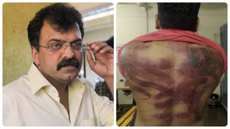 ‘I will pursue the case to its logical end’: Victim after SC orders probe into his assault at NCP MLA Jitendra Awhad’s home in 2020