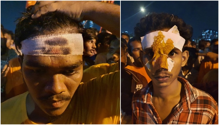 Malad Ram Navami violence: Radicals chanted ‘Allah-Hu-Akhbar’ before throwing stones and chappals causing severe injuries, 21 arrested and over 400 booked