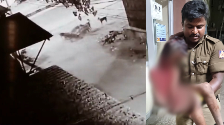 Caught on camera: 9-year-old boy attacked by stray dogs while going to mosque in Karnataka’s Kolar, rescued by a cop and hospitalised