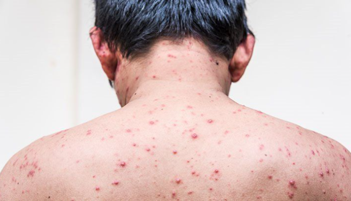 Representative Image from Everyday Health