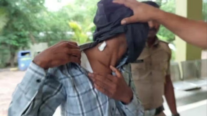 Maharashtra: Drunken Ishtiaq Khan bites friend Rahul Lohar in the neck to drink blood, Rahul kills him by smashing his head with a stone