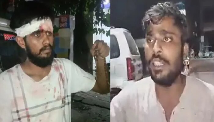 Uttar Pradesh: Two Hindu boys thrashed by Muslim mob in Meerut, rudraksha beads broken; one arrested