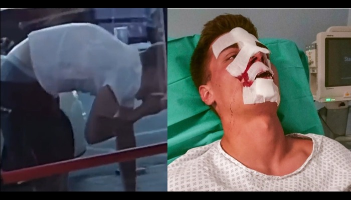 Italy: 19-year-old boy who escaped from war-torn Ukraine brutally attacked by a gang of 40 Tunisian and Libyan immigrants in Milan