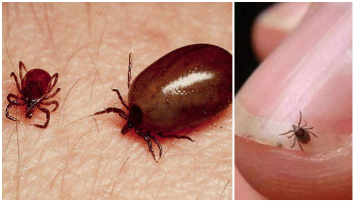 5 dead in Odisha's Bargarh district due to Scrub Typhus
