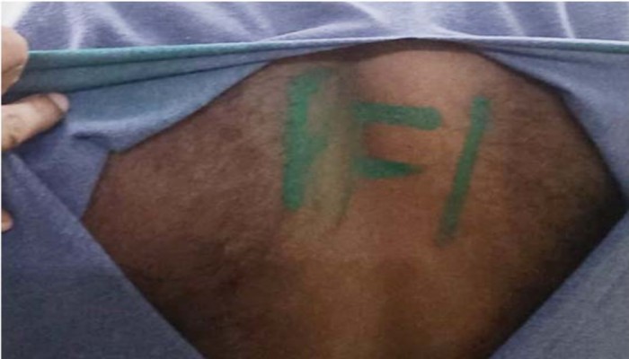 Kerala: Serving Army jawan tied up and assaulted in Kollam, ‘PFI’ in paint written on his back