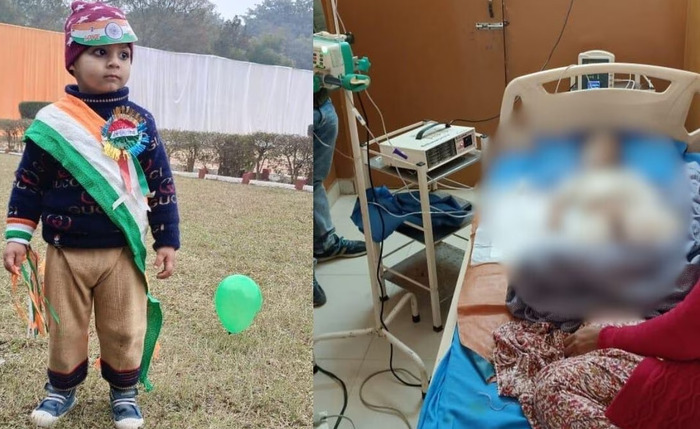 UP: Two-year-old child brutally attacked by stray dogs in Barabanki during Republic Day celebrations, over 40 wounds on his body