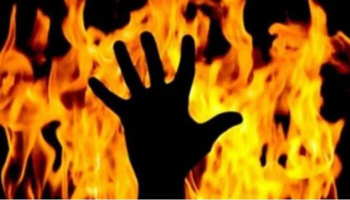 Delhi: Girl troubled by one-sided love of her cousin Abdullah burns him to death by pouring petrol, deceased had slit his vein on her engagement