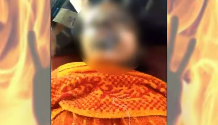 Madhya Pradesh: Wife of rape accused allegedly gang-raped, set ablaze by victim’s family