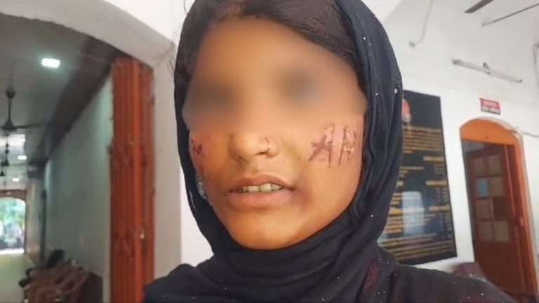 UP: Aman Hussain kidnaps and rapes a minor girl for declining his marriage proposal, writes his name on the victim’s face with a hot iron rod; booked