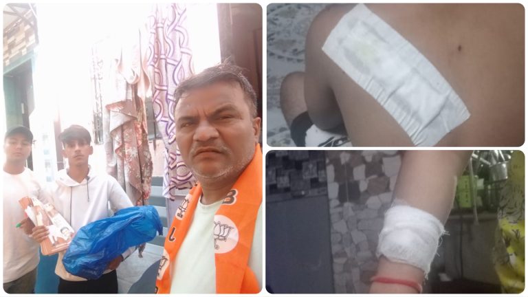 ‘You support BJP despite being a Muslim’: BJP worker in Mumbai’s Malvani assaulted by Nadir Mandap, believed to be a close aide of Congress MLA Aslam Shaikh