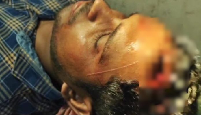West Bengal Poll violence: ANI reporter suffers severe head injury in stone pelting in Canning