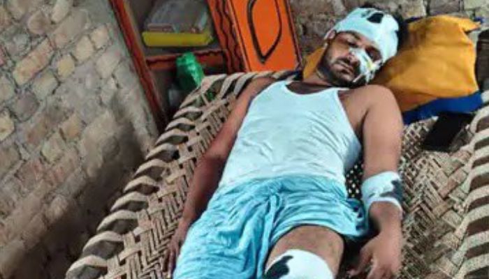 Haryana: Mohammed Zubair and others take Muslim man hostage in Nuh, assault him brutally for listening to DJ