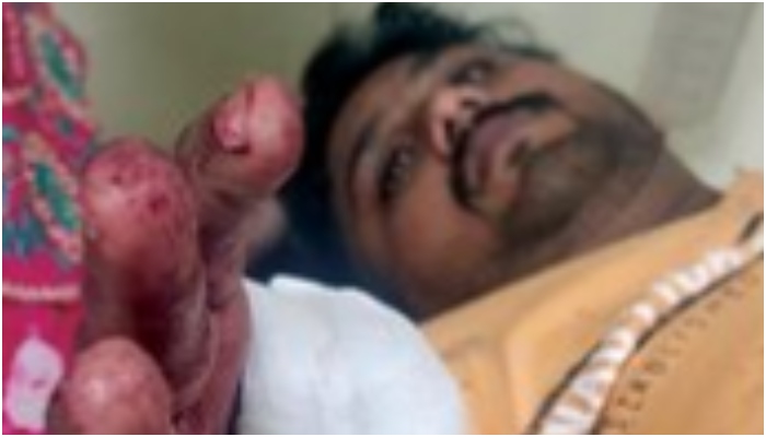 Pune: Salman, Sultan, and Aslam among 9 booked for brutally attacking a Dalit Hindu activist over his association with BJP. Read FIR details