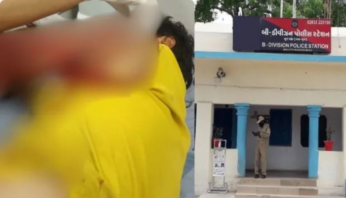 Gujarat: ‘Sir tan se Juda’ attempt on VHP member in Bhuj leaving him gravely injured, accused Nizam and Irfan arrested