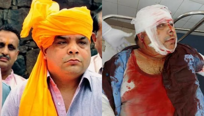 Punjab: Shiv Sena leader Sandeep Thapar, a descendant of martyr Sukhdev, assaulted with swords by Nihang Sikhs, severely injured