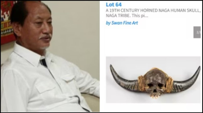 ‘Act of dehumanisation and continued colonial violence’: Nagaland CM seeks centre’s intervention to stop proposed auction of Naga human skull in UK
