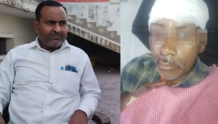 Bahraich: Head smashed, jaw torn- Sudhakar Tiwari was attacked by an Islamist mob, found unconscious near a mosque, says brother