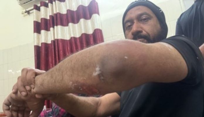 Army veteran demands justice for Colonel Pushpinder Singh Bath, assaulted by Patiala police