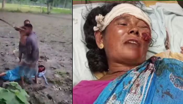 Hindu Woman Attacked with Weapons in Bangladesh; Police Investigate